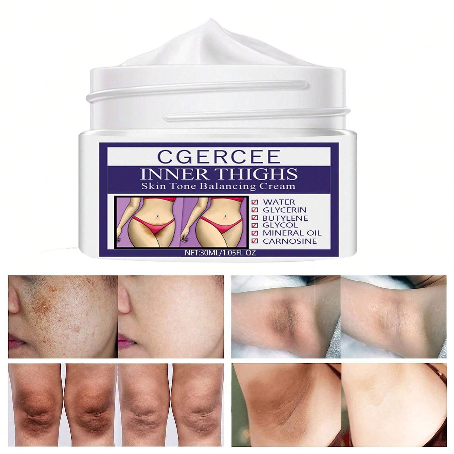 Dark Spot Repair Cream - 30ml: Enhances Skin Tone and Texture for Face, Neck, Armpit, Hand, Foot, and Joints.