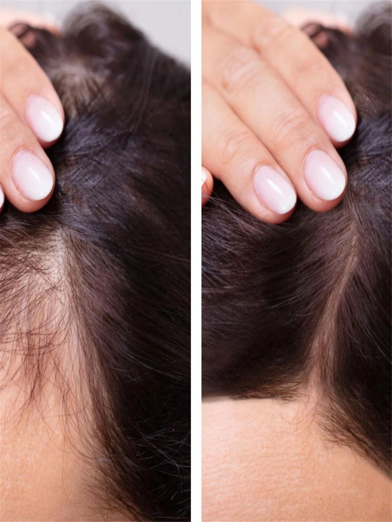 5ML/15ML/30ML/50ML Hair Growth Serum Anti Preventing Hair Loss Alopecia Liquid Damaged Hair Repair Growing Faster