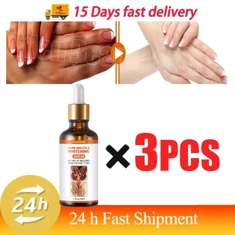 Dark Knuckles Fast Whitening Serum Hand Knuckle Elbows Knee Melanin Corrector Intense Stains Remover Products Beauty Care 50ml