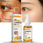 Remove Dark Spots Turmeric Essential Oil Anti Wrinkle Face Serum Therapeutic Acne Shrink Pores Whitening Moisturizing Skin Care